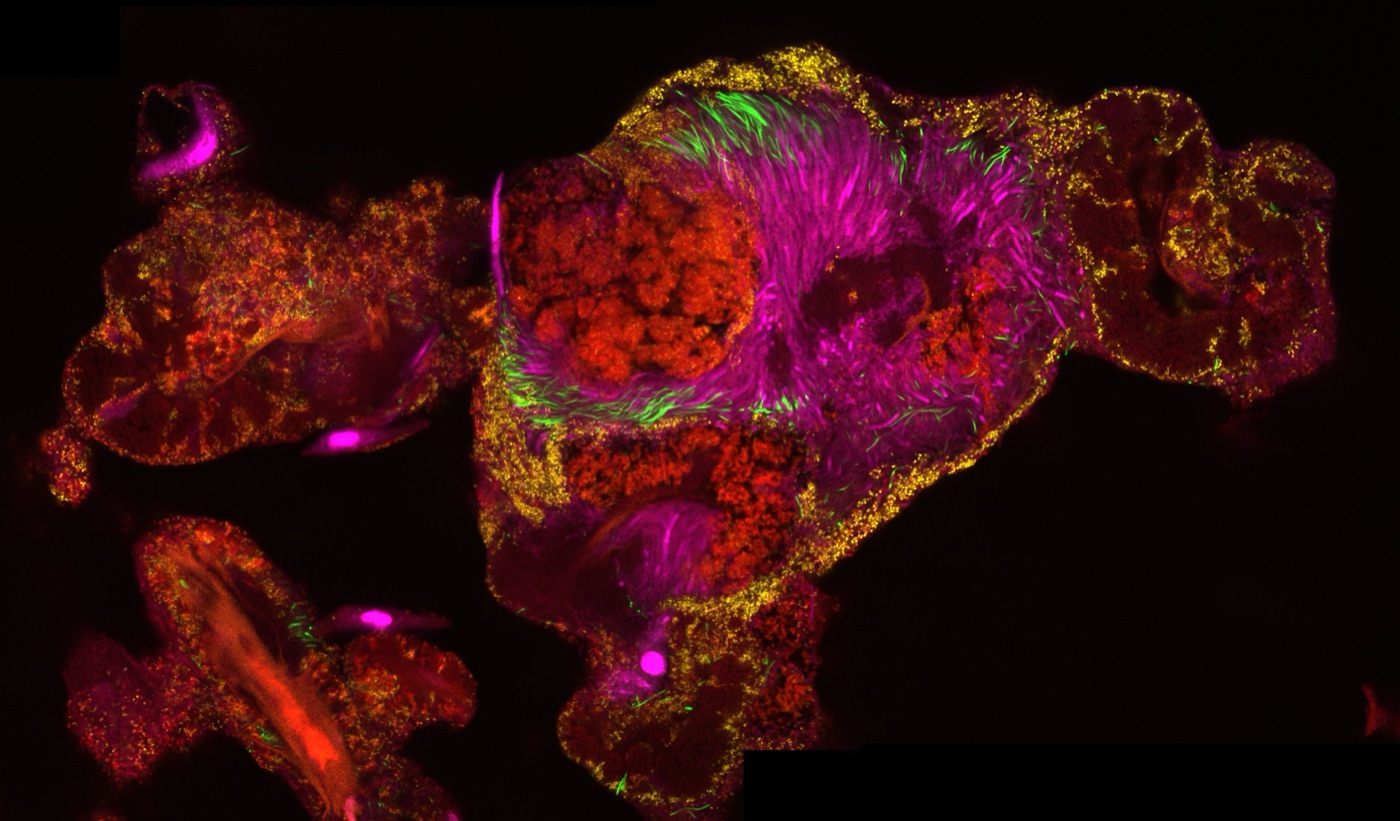 Tongue dorsum scraping stained by 16S rRNA fluorescence in situ hybridization