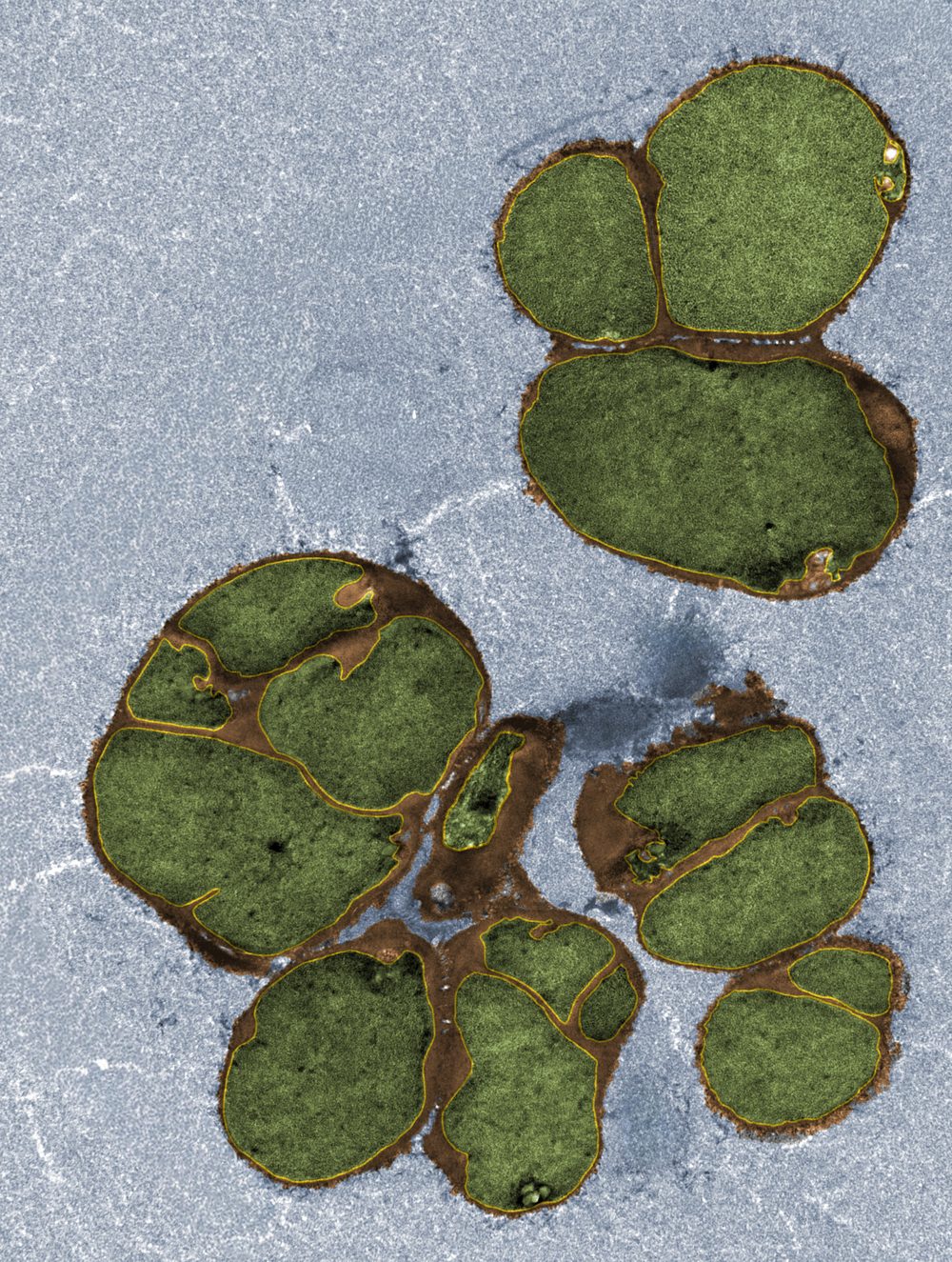 False-colored transmission electron micrograph of Bacillus subtilis cells fully depleted for wall teichoic acids